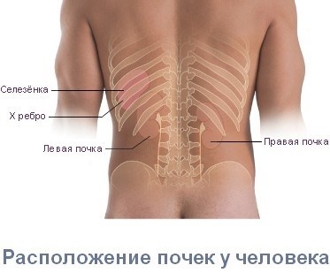 Заболевания опорно-двигательного аппарата, вызывающие боль в пояснице: