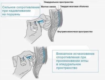 Как рассчитать дополнительный больничный?